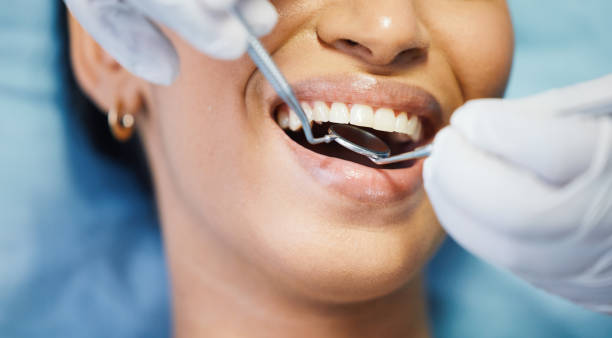 Best Broken or Cracked Tooth Emergency Dentist in Rancho San Diego, CA
