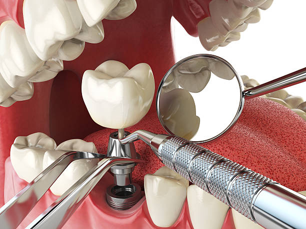 Best Pediatric Emergency Dentist in Rancho San Diego, CA